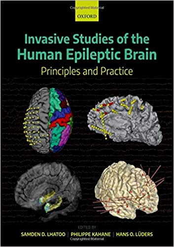 Invasive Studies of the Human Epileptic Brain Principles and Practice